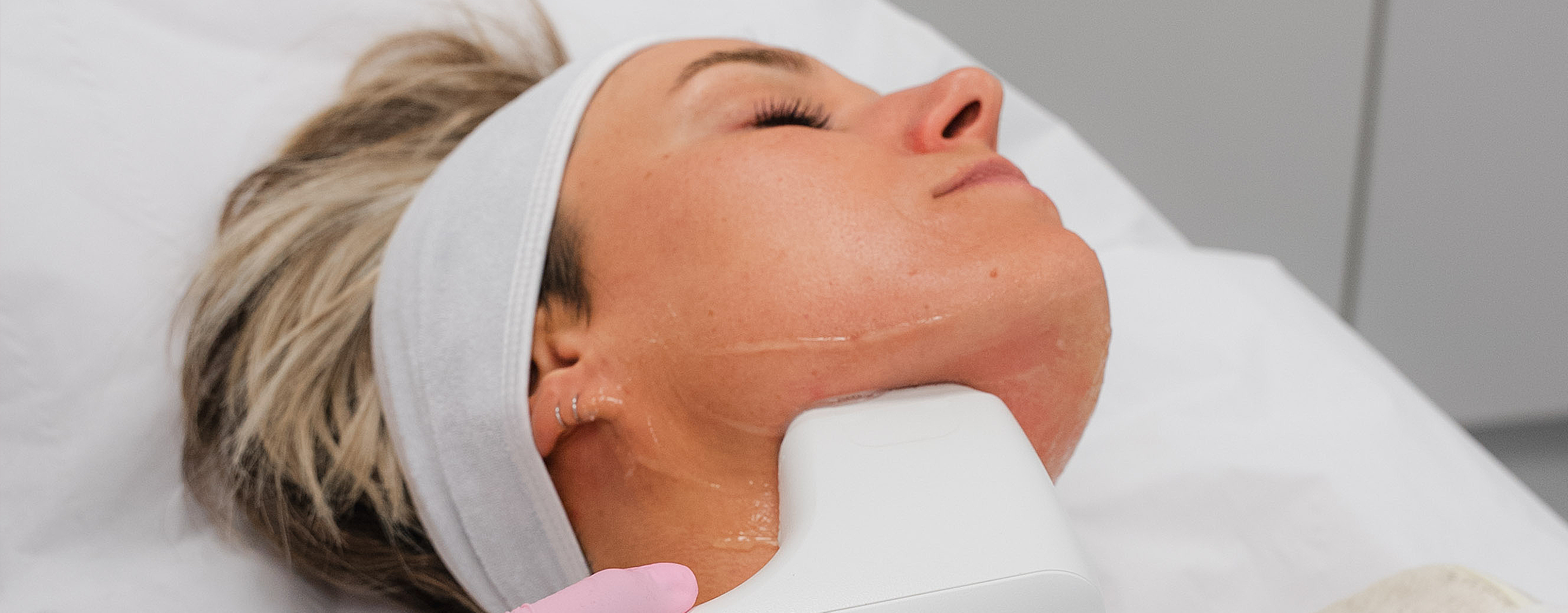 Sofwave Ultrasound verstrakking Gent