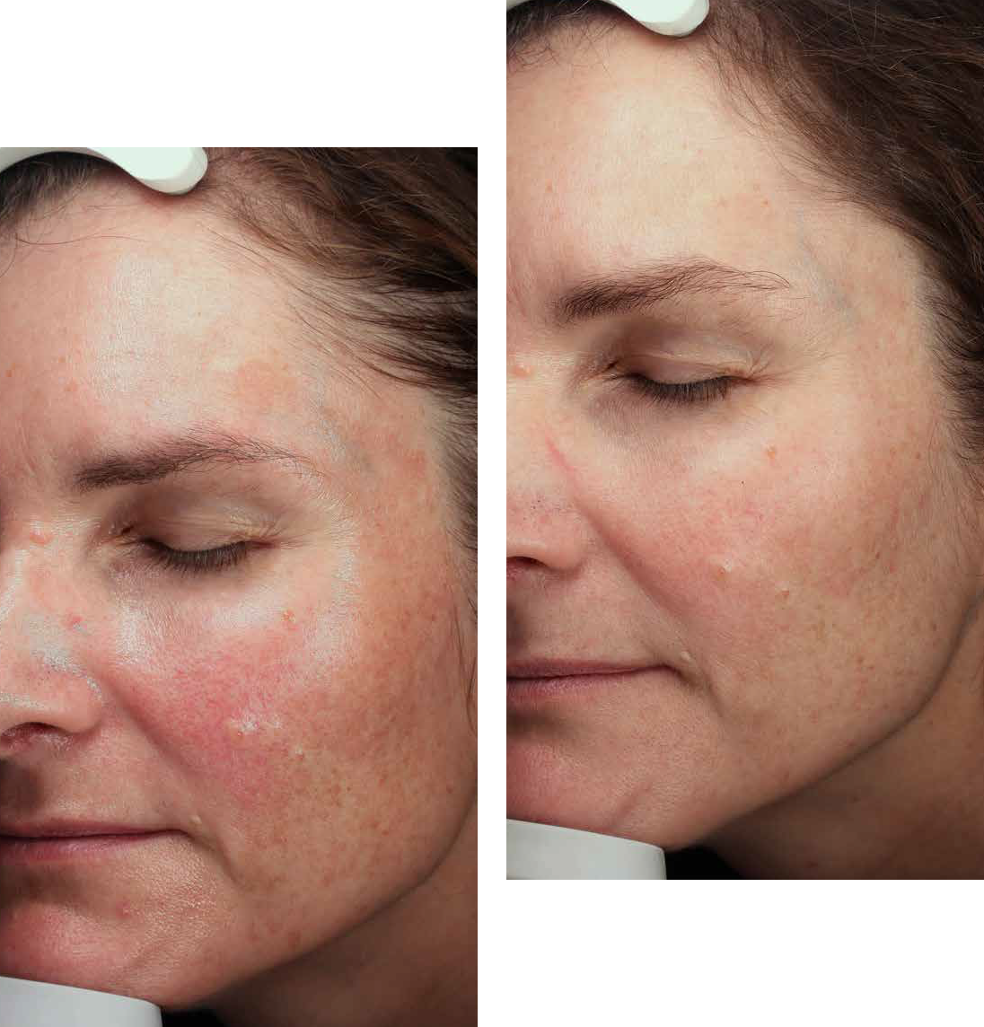 De-kracht-van-de-thuisbehandeling