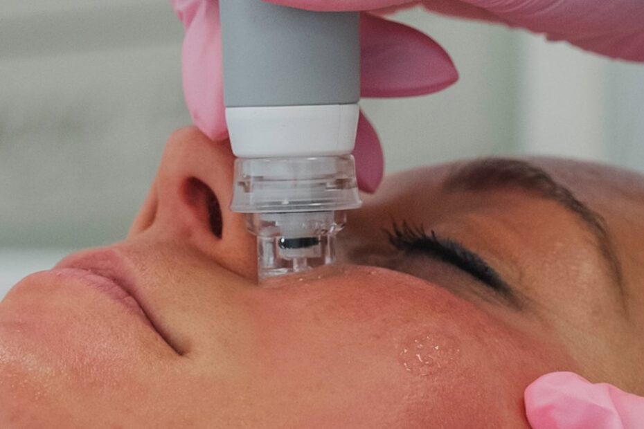 Dermafacial Gent poriën verfijnen – Art Medico Clinic