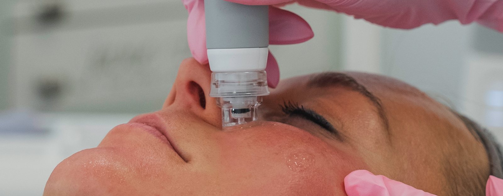 Dermafacial Gent poriën verfijnen Dermafacial Gent poriën verfijnen – Art Medico Clinic