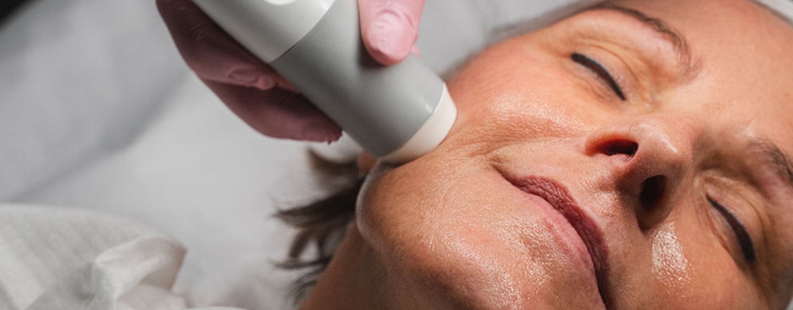Dermafacial