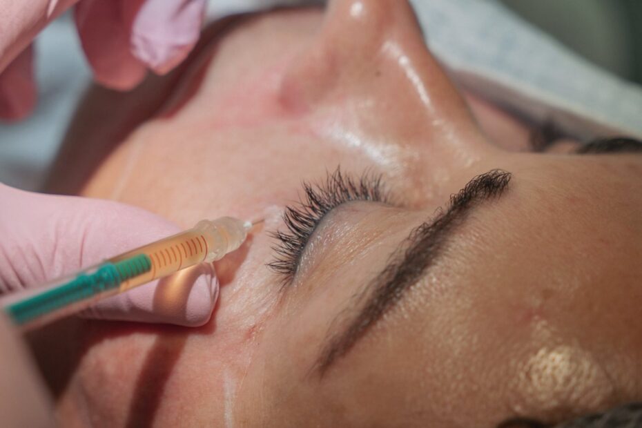 PRP behandeling Gent frisse huid – Art Medico Clinic