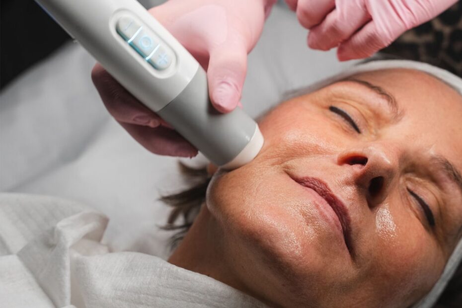 Dermafacial glow – Art Medico Clinic